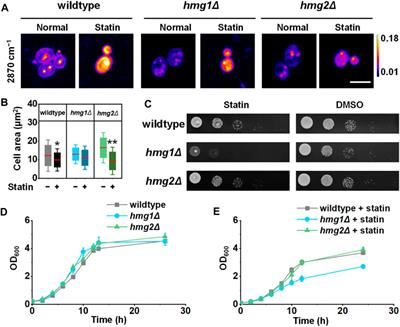 Spatial sterol metabolism unveiled by stimulated Raman imaging